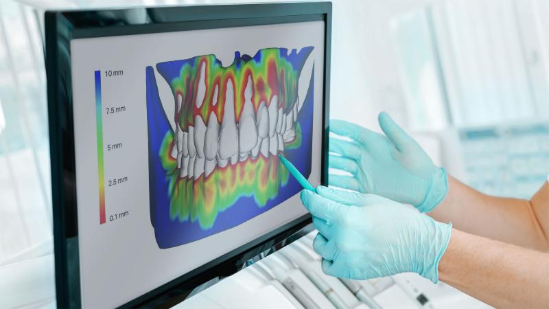 an image of a cbct on a screen