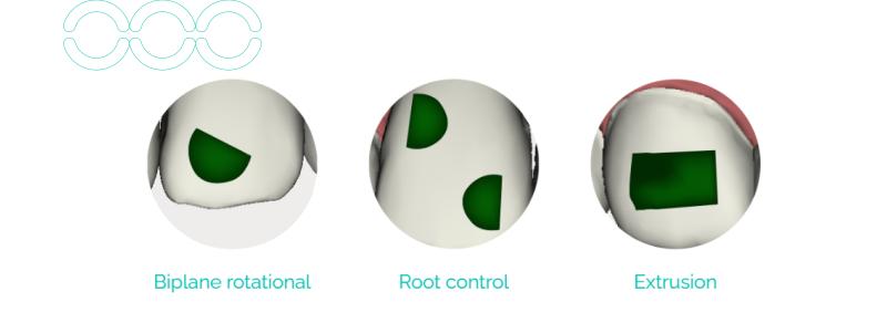 3D Image of Eon Aligner's attachments (horizontal, vertica and rotational)