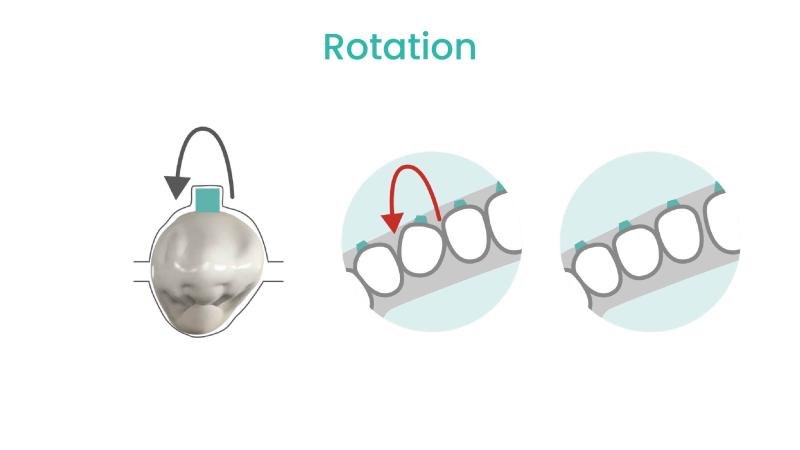 Rotation movement of teeth 