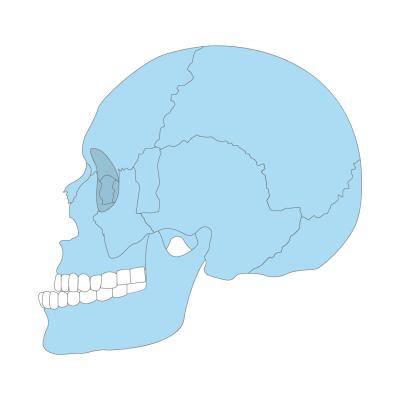 skeletal underbite